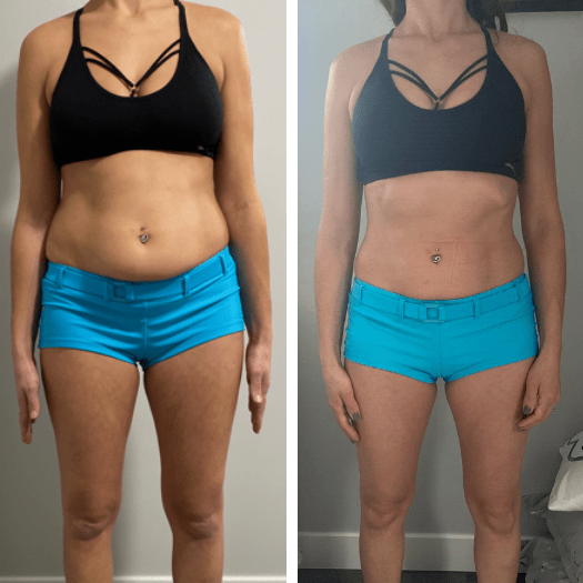 Fernanda Ferreira: Libertou-se de 2 kg em 3 meses.