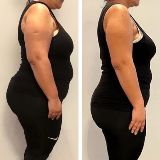 Julia Catarina: Libertou-se de 16 kg em 9 meses.